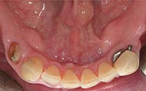 oakville emergency dentist