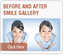 Dental Service - Before and After Images
