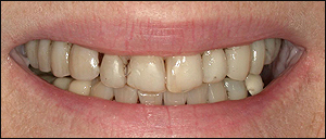 Oakville Cosmetic Dentistry